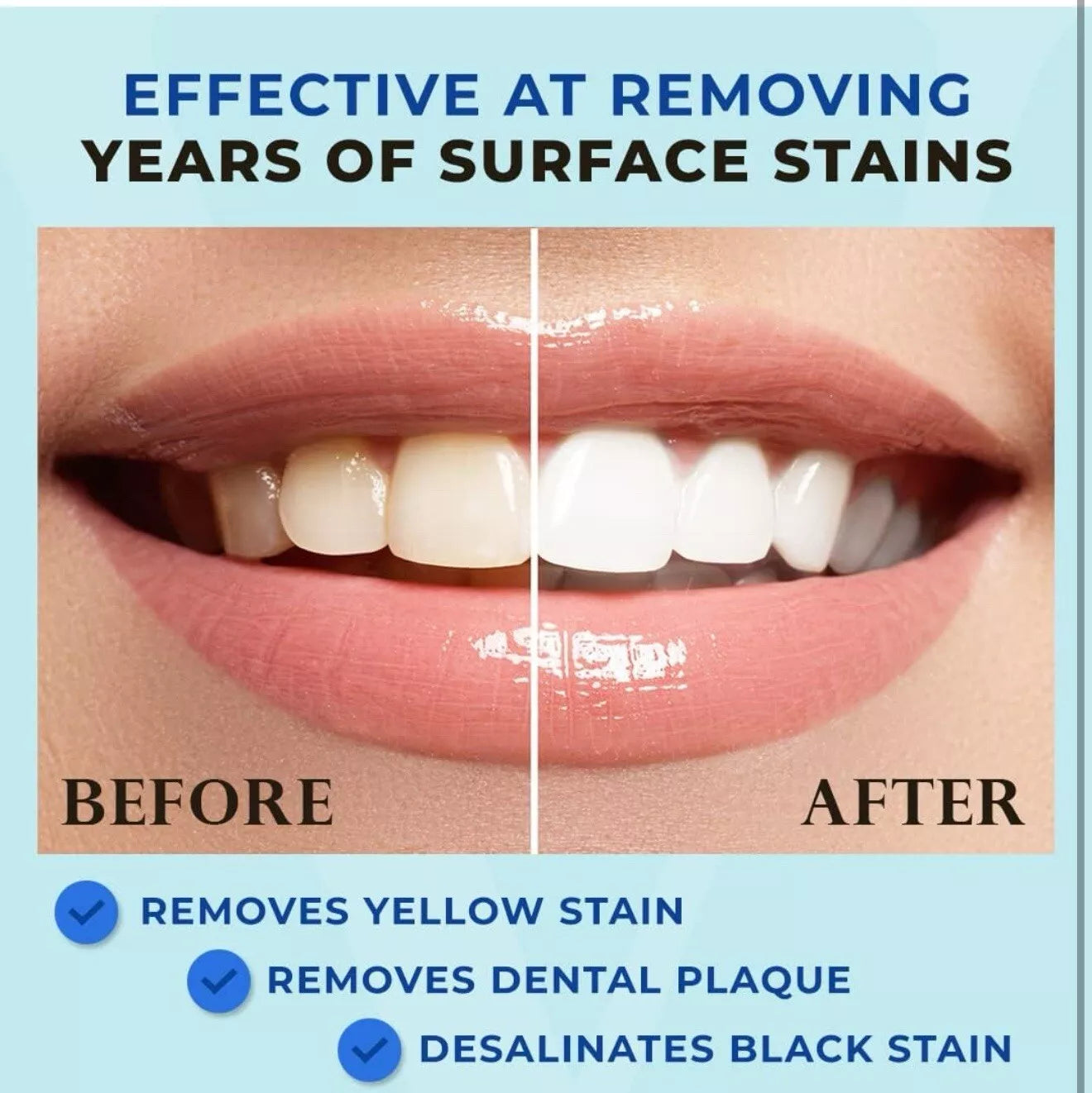Venus Visage Award Winning Teeth Whitening Pen, 6 Pen For 12.99 !! Good Reviews!